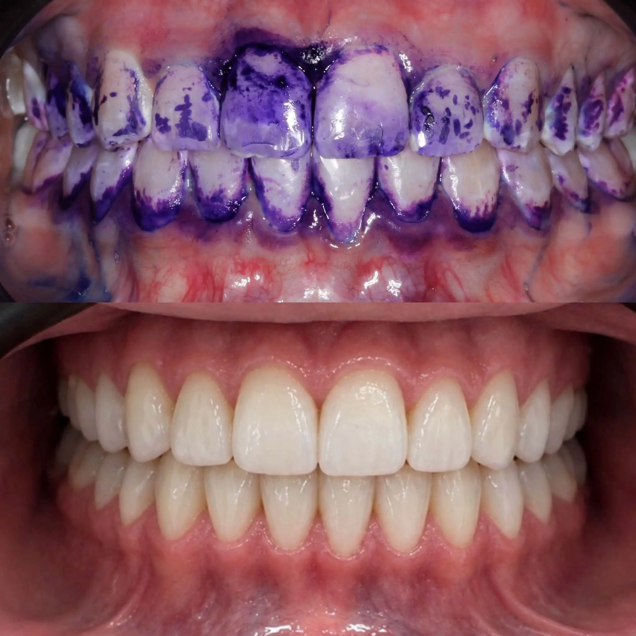 Airflow hygiene treatment